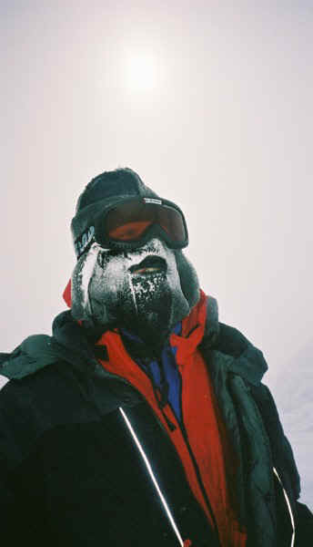 Me, AKA Frosty Gimp!